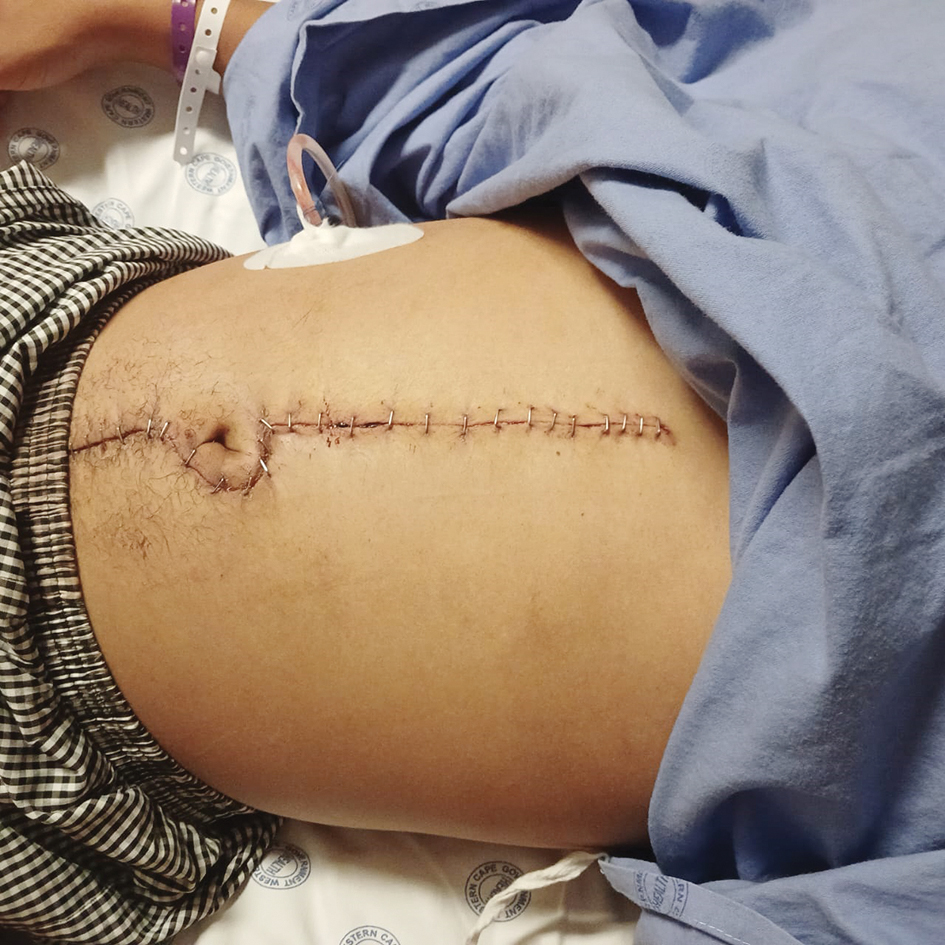 Man (24) in hospitaal na beweerde aanranding